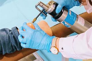 Crioterapia Belén Encabo Alicante Crioterapia Belén Encabo Alicante