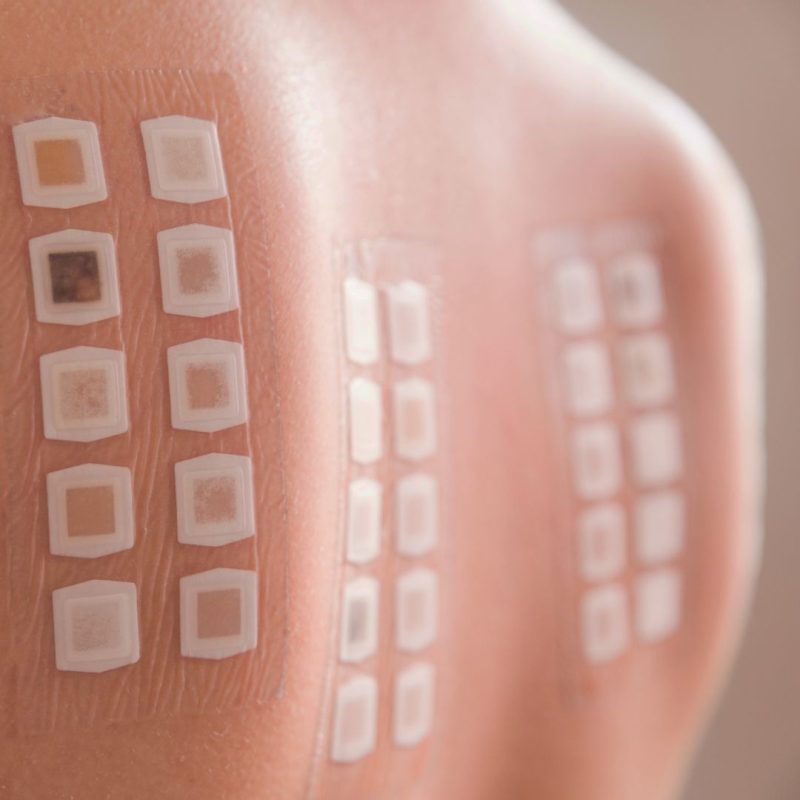 Epicutaneous Tests - Patch Test Alicante | Belaneve